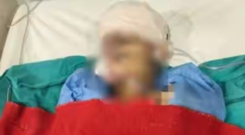 BHU Dog Attack Case